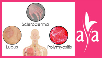 What is polymyositis disease?