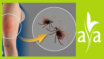 Lyme Disease