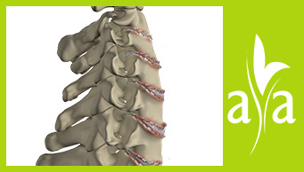 Spondyloarthritis