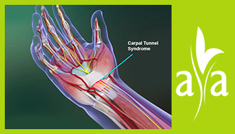 Carpal Tunnel Syndrome